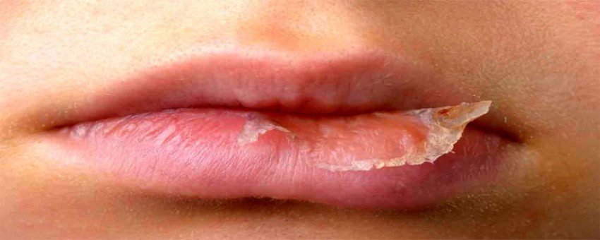 احتیاط در حین استفاده از رژ لب