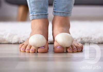 قارچ پوستی چگونه به وجود می آید؟ انواع آن