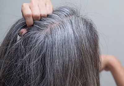 راز موهای سفید؛ کمبود ویتامینی که باعث سفید شدن موها می‌شود؟