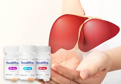 درمان کبد چرب با داروی رسمتیروم Resmetirom با تاییدیه FDA